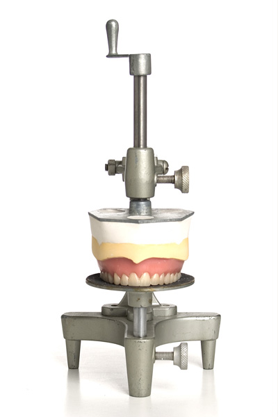 Anterior view of a template used to set and grind the maxillary teeth