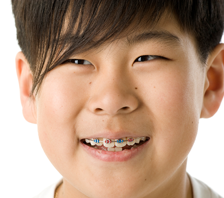 Child with braces