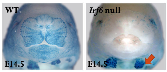 images of salivary glands